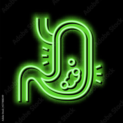 gastric disease neon glow icon illustration