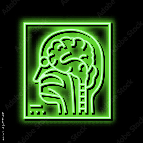 magnetic resonance imaging radiology neon glow icon illustration