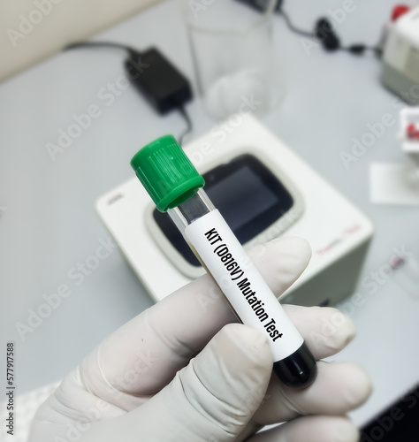 Blood sample for KIT D816V  mutation testing  to diagnosis of acute myeloid leukemia and mastocytosis.