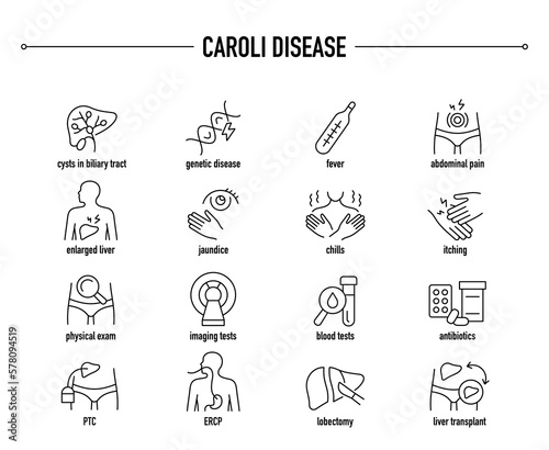 Caroli Disease symptoms, diagnostic and treatment vector icon set. Line editable medical icons.