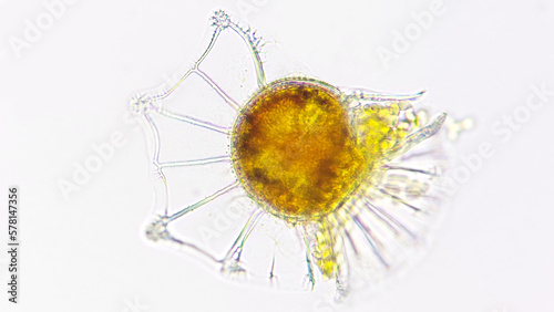 Ornithocercus, a marine dinoflagelate armored with overlapping cellulose plates. Lugol-preserved sample. 400x magnification photo