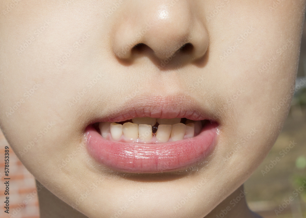 Naklejka premium A child's face showing teeth