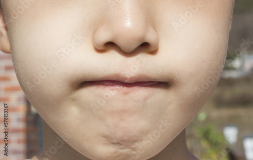 This is the face of an Asian child with tightly closed lips.