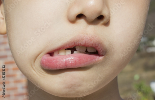 
A child's face showing teeth photo