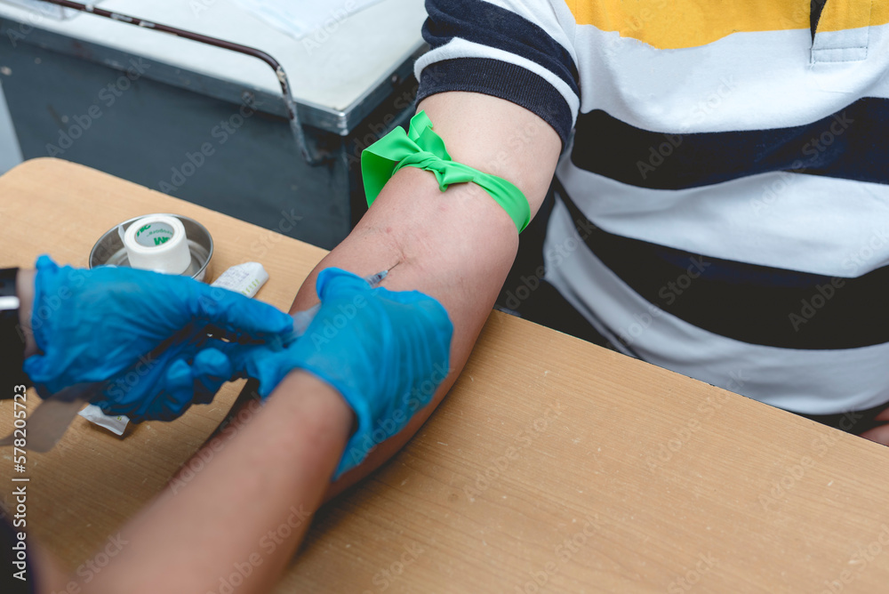 A nurse or phlebotomist draws blood from the vein of a patient. An IV