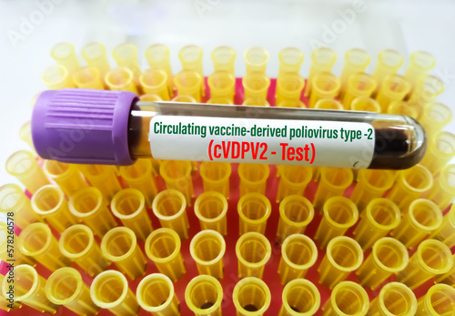 Billede på lærred Blood sample tube for circulating vaccine-derived poliovirus type 2 (cVDPV2) tes
