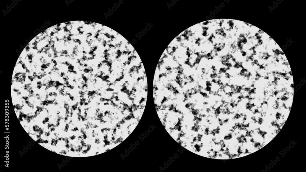 Zoom Animation Close Up Of The Viewfinder On A Microscope to the Bacteria on two eyes on dark background Zoom Animation Close Up Of The Viewfinder On A Microscope to the Bacteria on two eyes on dark background