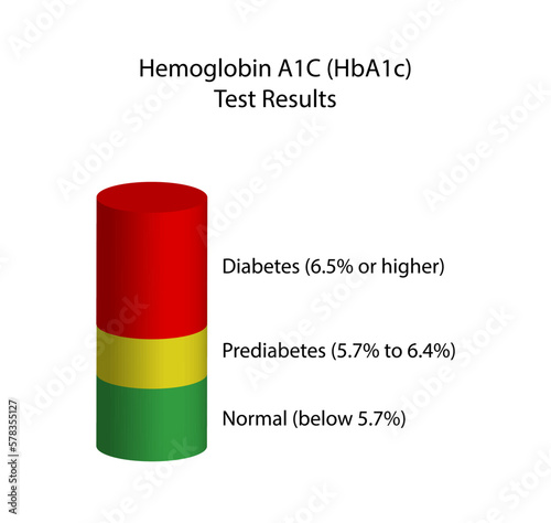 Hemoglobin A1C, HbA1c test results, glycated hemoglobin, A1C Blood Sugar Test, Diabetes Mellitus. Vector illustration.	
