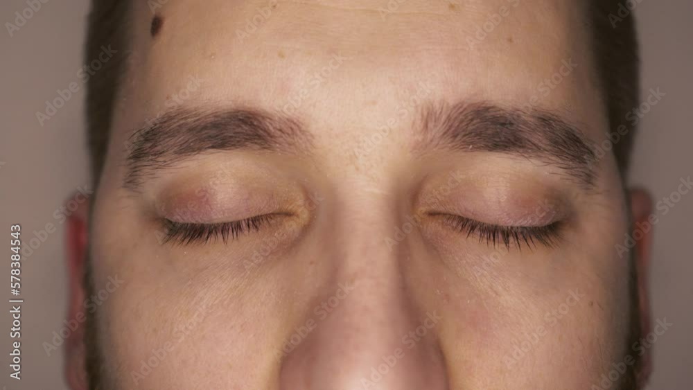 Green eyes close-up with capillaries. The concept of ophthalmology and medicine. Views in different directions. Green eyes close-up with capillaries. The concept of ophthalmology and medicine. Views in different directions.