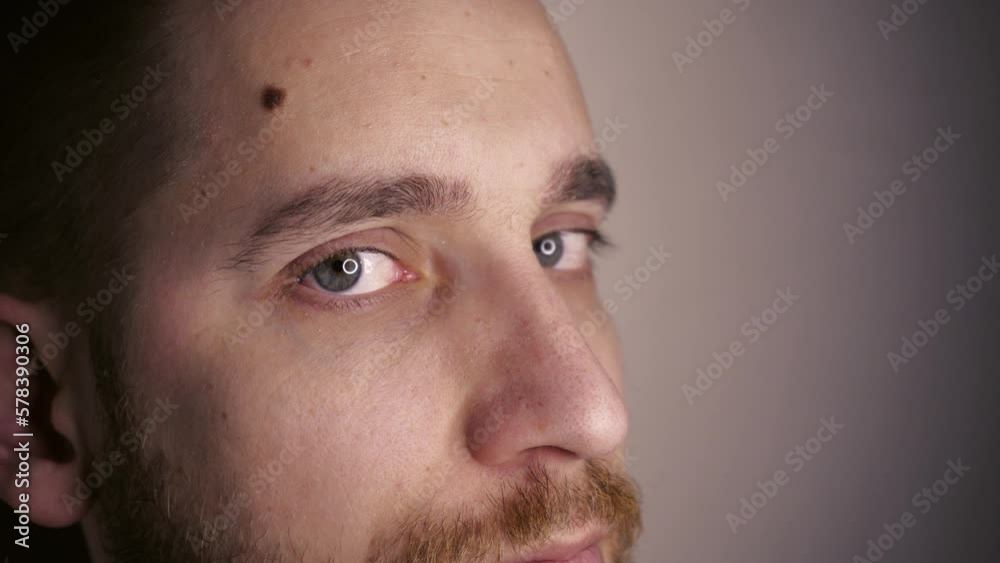 Green eyes close-up with capillaries. The concept of ophthalmology and medicine. Views in different directions. Green eyes close-up with capillaries. The concept of ophthalmology and medicine. Views in different directions.
