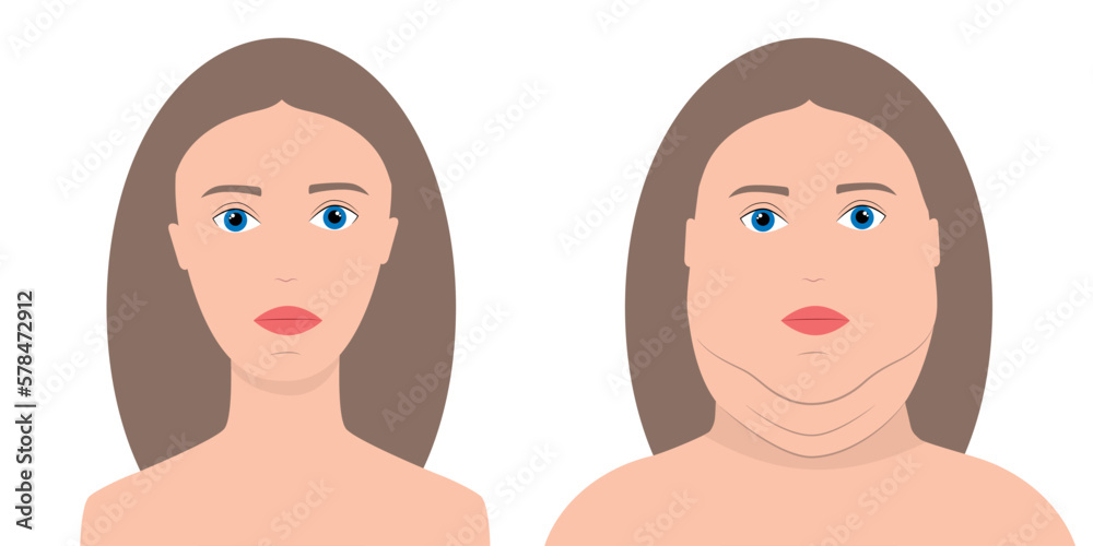 Skinny and overweight woman. Before and after weight loss concept Skinny and overweight woman. Before and after weight loss concept