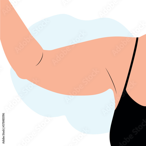 Fat arm of overweight woman photo