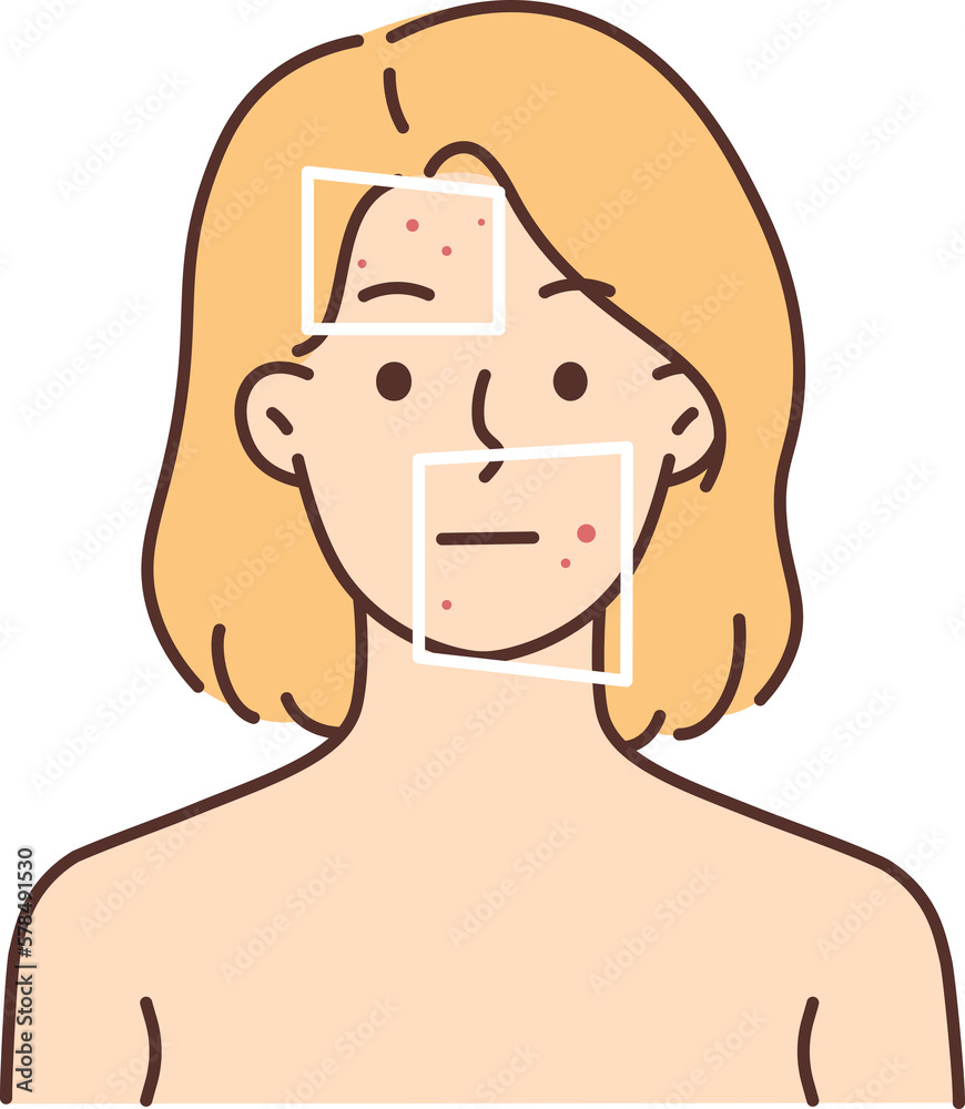 Woman with red pimples on face