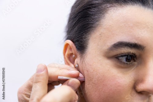 Dry needle treatment. A portrait of a small acupuncture needle sticking in a person's face next to the nose, to heal pain, relieve stress or another medical condition with alternative medicine.