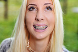 closeup of teeth in braces of girl's mouth