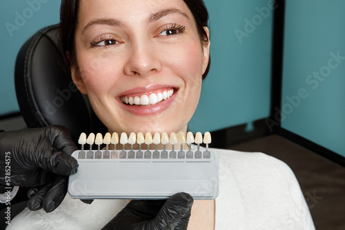 Smile and white teeth of a young woman. Matching the shades of the implants or the process of teeth whitening.