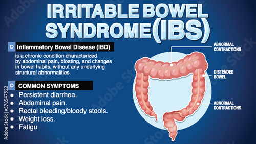 Irritable Bowel Syndrome (IBS) Infographic