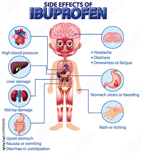 Human anatomy diagram cartoon style of ibuprofen side effects