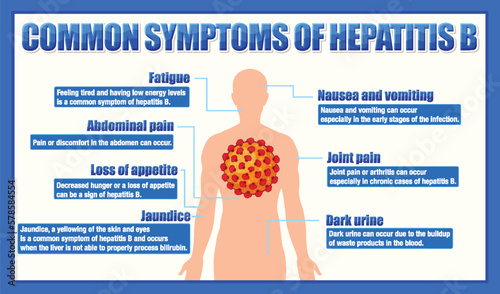Informative poster of common symptoms Hepatitis B