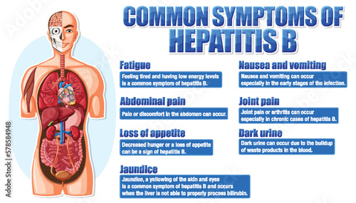 Informative poster of common symptoms Hepatitis B