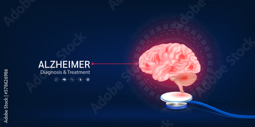 Alzheimer disease. Human brain model float away from stethoscope. Doctor diagnosis treatment. Medical technology innovation concept. Banner design for pharmacy clinic. 3d Vector.