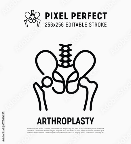 Arthroplasty thin line icon, artificial joint, surgical procedure to restore joint. Arthritis. Pixel perfect, editable stroke. Vector illustration.
