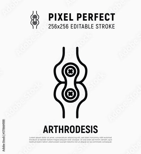Arthrodesis joint surgery thin line icon. Arthritis. Pixel perfect, editable stroke. Vector illustration.