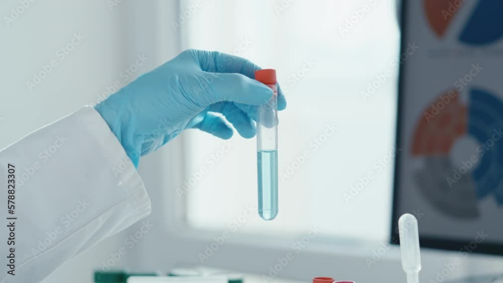 Medical research laboratory. A scientist works with a pipette and a test tube. Scientific laboratory of biotechnology, development of medicine and research in chemistry, biochemistry and experiments. Medical research laboratory. A scientist works with a pipette and a test tube. Scientific laboratory of biotechnology, development of medicine and research in chemistry, biochemistry and experiments.