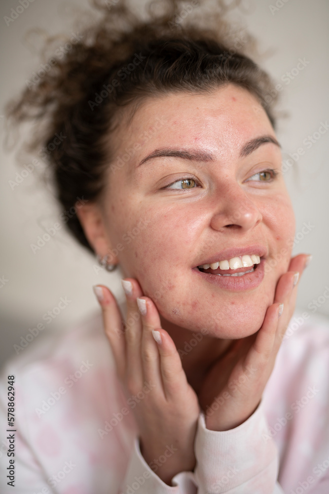 Young beautiful woman with akne skin making home beauty tretment Young beautiful woman with akne skin making home beauty tretment