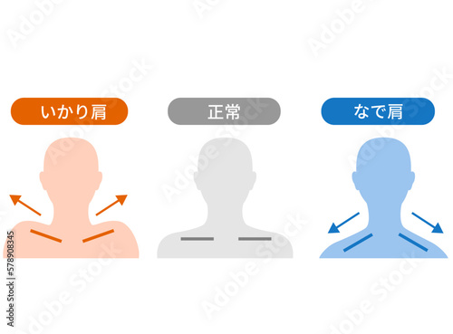 いかり肩となで肩の違い