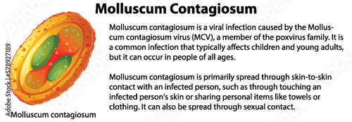 Molluscum Contagiosum with explanation photo