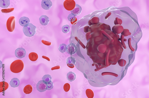 Auer rods (or Auer bodies) in acute Hypergranular Promyelocytic Leukemia (APL) - 3d illustration closeup view photo