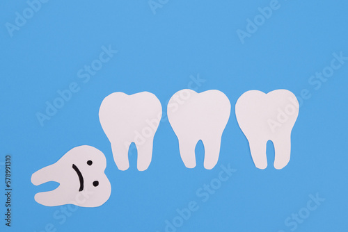 Horizontal, mesial wisdom tooth with frustrated grimace, creative paper model photo