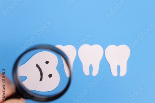 Horizontal, mesial wisdom tooth under a paper magnifier. The concept of medical examination, x-ray