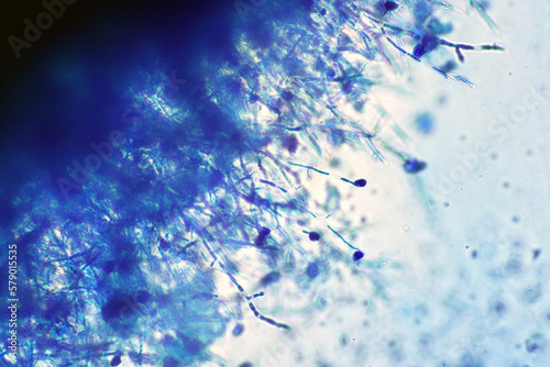 Microscope of black fungus spore strain with Lactophenol cotton blue, molds or yeasts with macro 40x lens, contamination in air room, pollution aerosol environmental. Microbiology laboratory concepts. photo