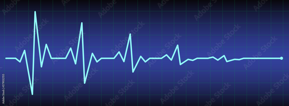 ecg, ekg monitor with cardio diagnosis illustration. Heart rhythm line vector design to use in healthcare, healthy lifestyle, medicine, ekg, ecg concept illustration projects.
