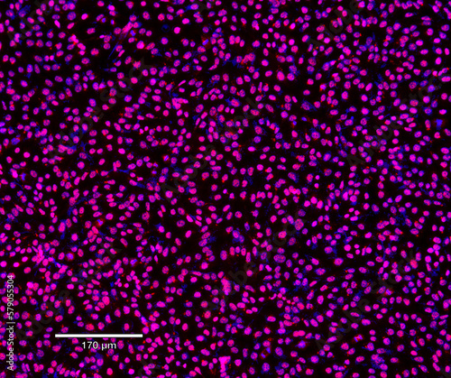 Immunofluorescence Staining in Research Laboratory photo