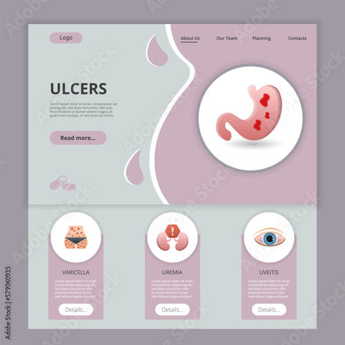 Ulcers flat landing page website template. Varicella, uremia, uveitis. Web banner with header, content and footer. Vector illustration.