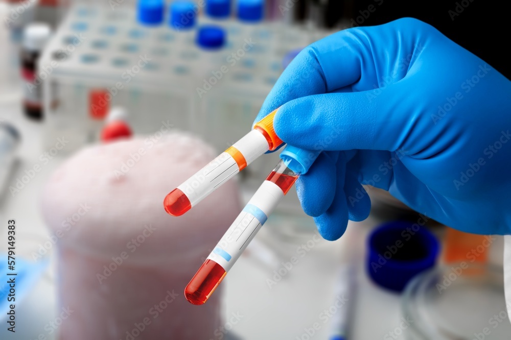 Doctor holding test tube with blood Doctor holding test tube with blood