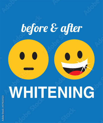 Funny cartoon characters before and after whitening, vector illustration. Teeth whitening. Dental care Before and after view of teeth whitening