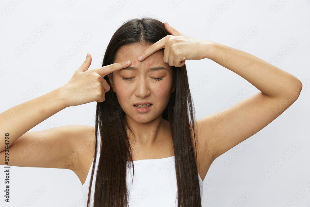 Asian woman facial skin problems, acne and inflammation, red rashes and allergies, chicken pox, sadness from rashes. Facial skin care concept for diseases and nerves