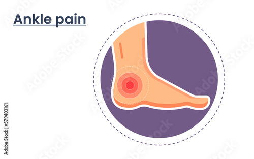 Vector illustration of ankle pain. body point pain template. medical infographics concept. physiotherapy concept.