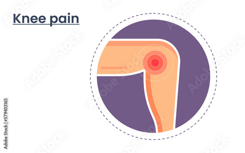 Vector illustration of knee pain. body point pain template. medical infographics concept. physiotherapy concept.