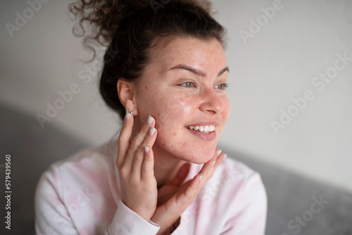 Foto Young beautiful woman with problem skin, acne, doing home cosmetic care