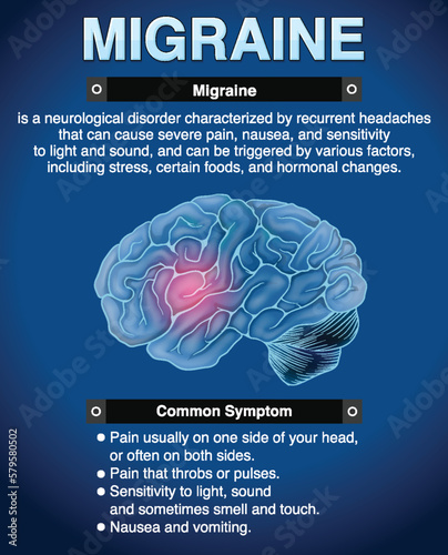 Informative poster of Migraine