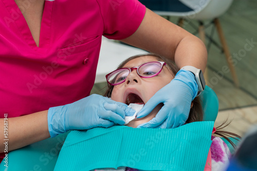 dentist cleaning a girl's teeth with gauze after giving her a dental cleaning treatment