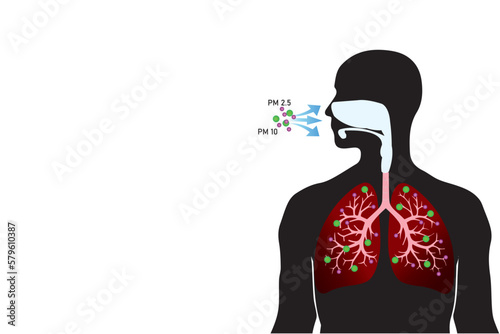 The impact of air pollution with PM 2.5 microns on the human lungs. 