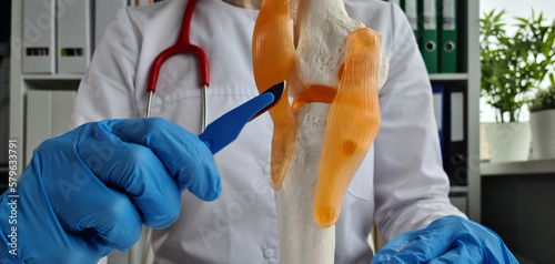 Photography Surgeon holding scalpel near model of knee joint in clinic