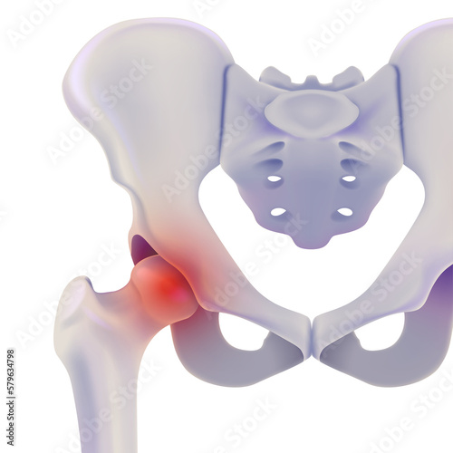 3D illustration of anterior view of hip bone showing painful position on white. medical use Education and Commerce.