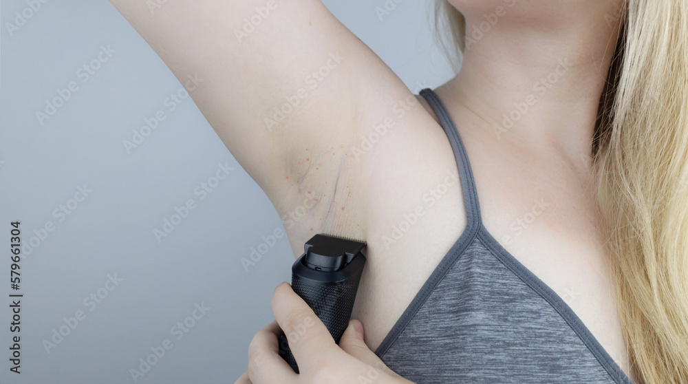 Armpit rash. Underarm skin irritation. Blonde girl shows irritation on the skin after using a